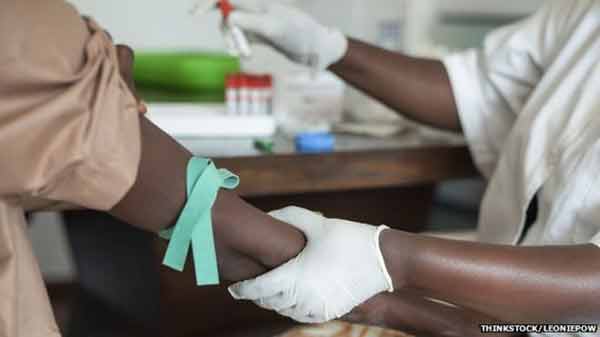 HIV goal to treat 15 million is met