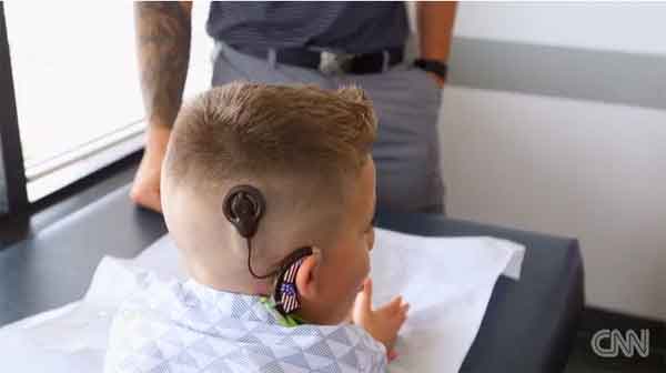 ‘Bionic ear’ lets deaf boy hear for the first time in US
