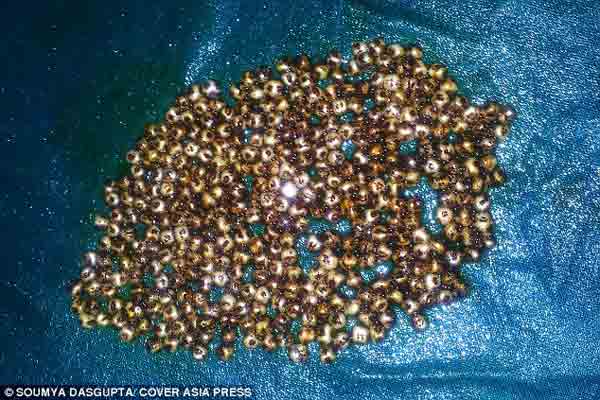 Surgeons’ find 360 gallstones inside Indian woman
