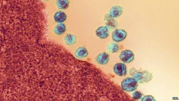 HIV flushed out by cancer drug