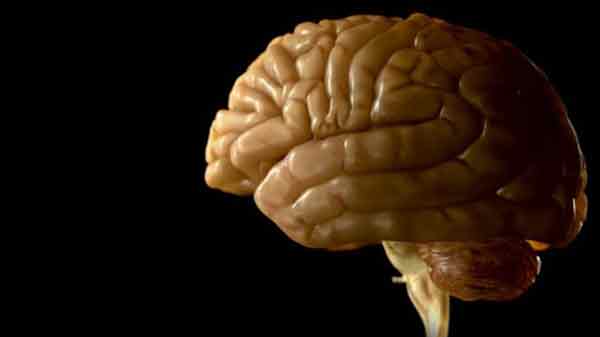 Frontal brain wrinkle linked to hallucinations
