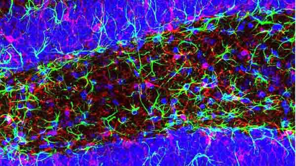 New Alzheimer’s brain target discovery