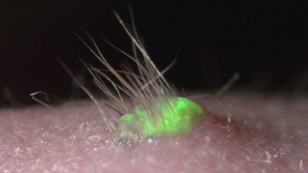 Lab-grown skin sprouts hair and glands