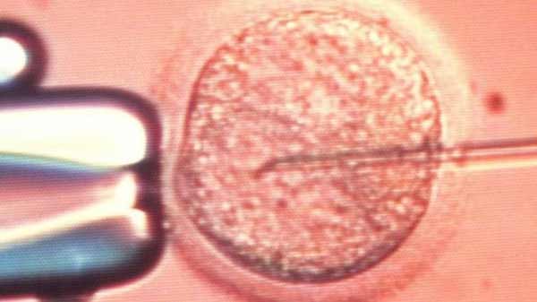 Dutch IVF centre probes suspected sperm mix-up