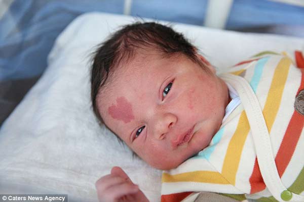 Baby born with a heart-shaped birthmark!