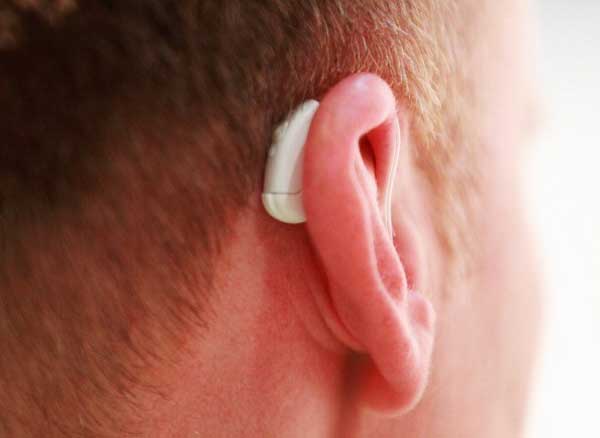Hearing loss is caused by anemia