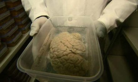 Donate your brain, scientists urge