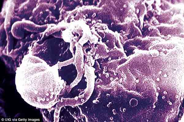 Scientists discover last unknown structure of HIV virus