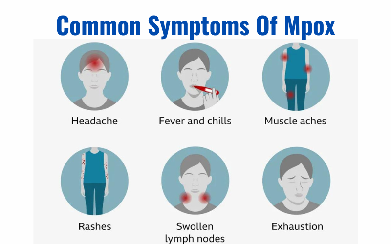 mpox symptoms.